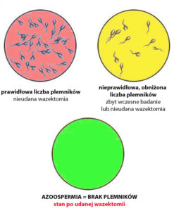 wazektomia-badanie-nasienia-po-zabiegu
