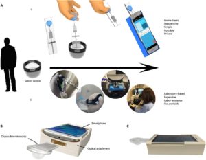vasectomy - the newest testing method afterwards vasectomy - test your semen with a smartphone